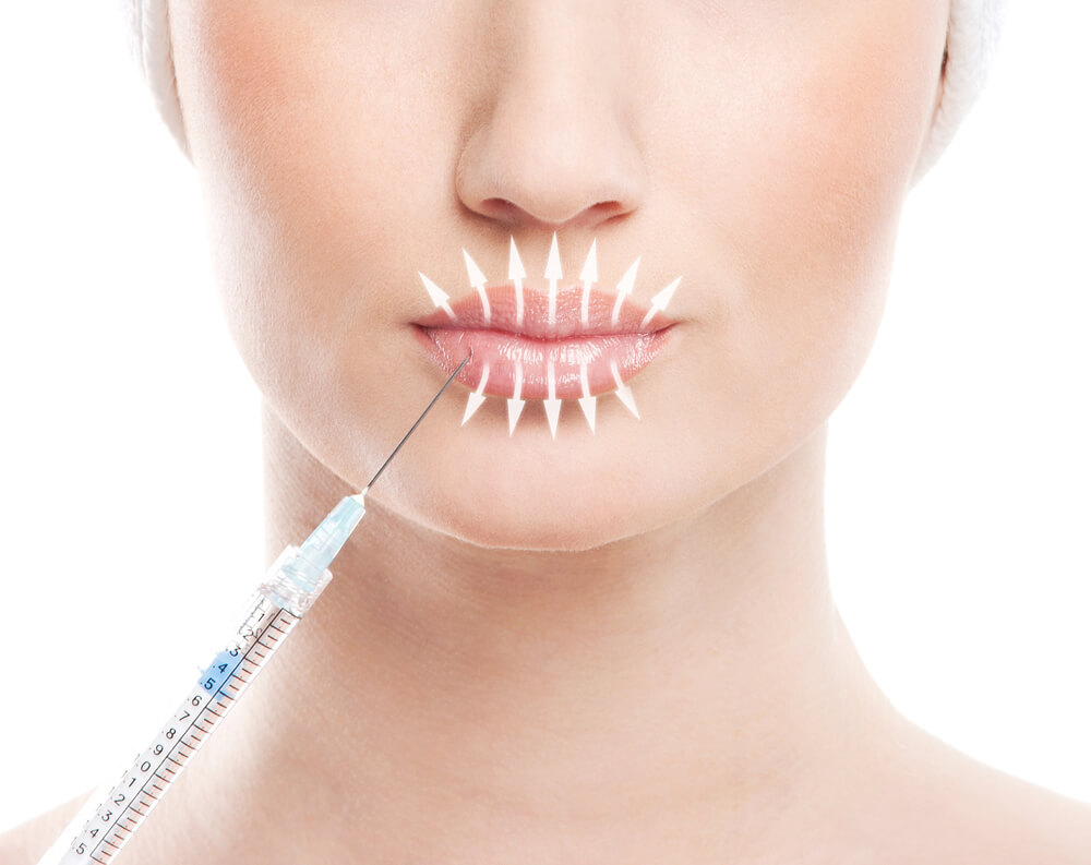 how to get rid of wrinkles around your mouth from smoking
