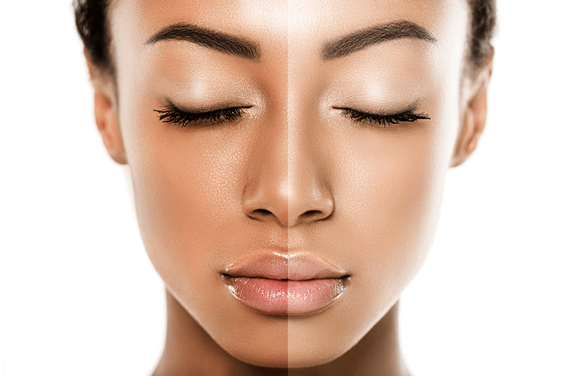 naturally whitening skin